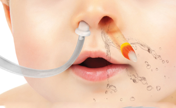 Foreign Body Removal