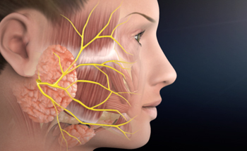 Parotid Surgery
